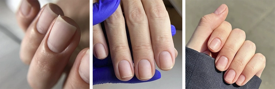 Nagelversteviging