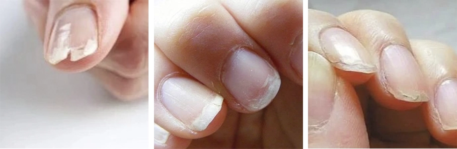 hoe kun je nagels versterken